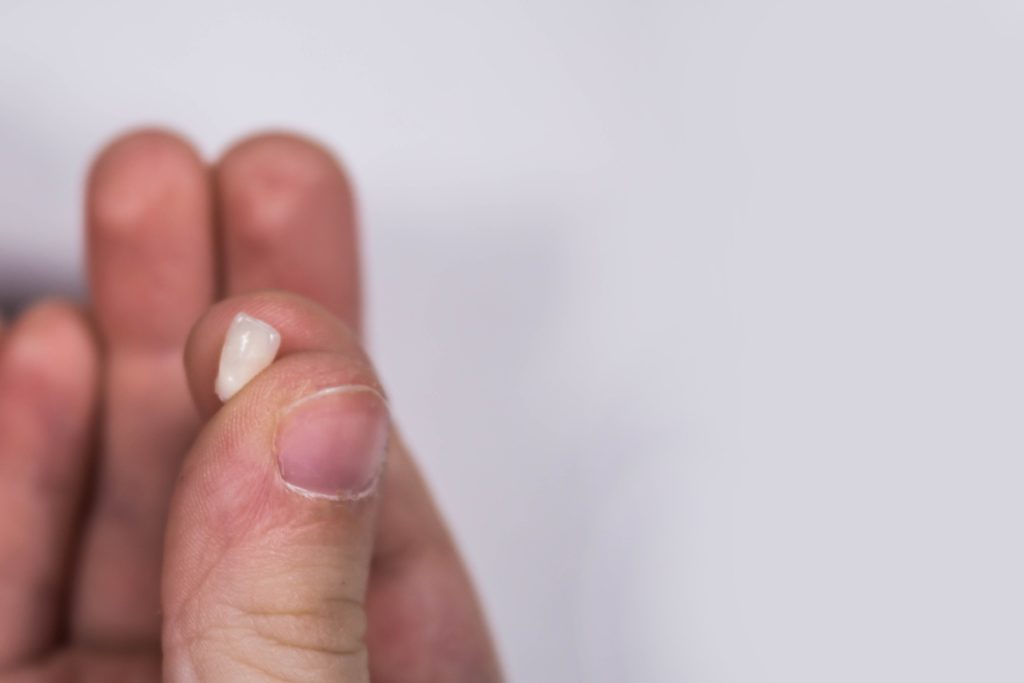 Replacing a Knocked-Out Tooth