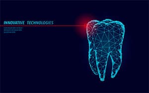 dental laser