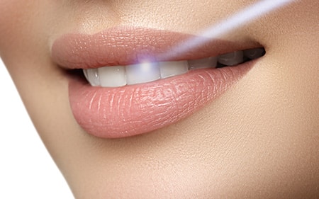 Laser dentistry Treatments Anchorage